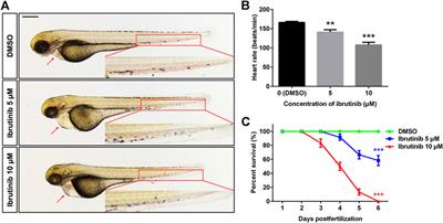 The Bruton’s Tyrosine Kinase Inhibitor Ibrutinib Impairs the Vascular Development of Zebrafish Larvae